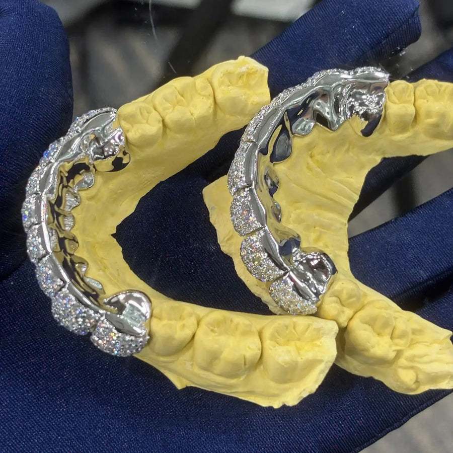 CUSTOMIZED ICED OUT TOP & BOTTOM S925 SILVER VVS MOISSANITE GRILLZ