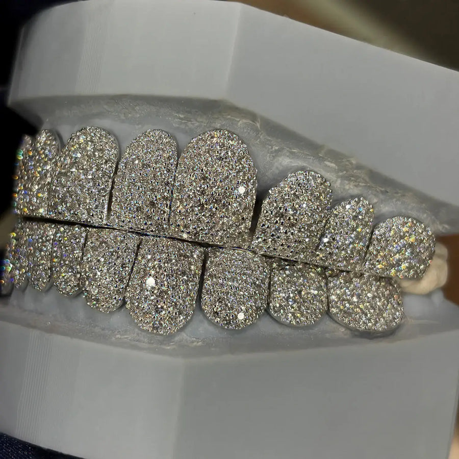 CUSTOM TOP & BOTTOM VVS MOISSANITE HONEYCOMB GRILLZ